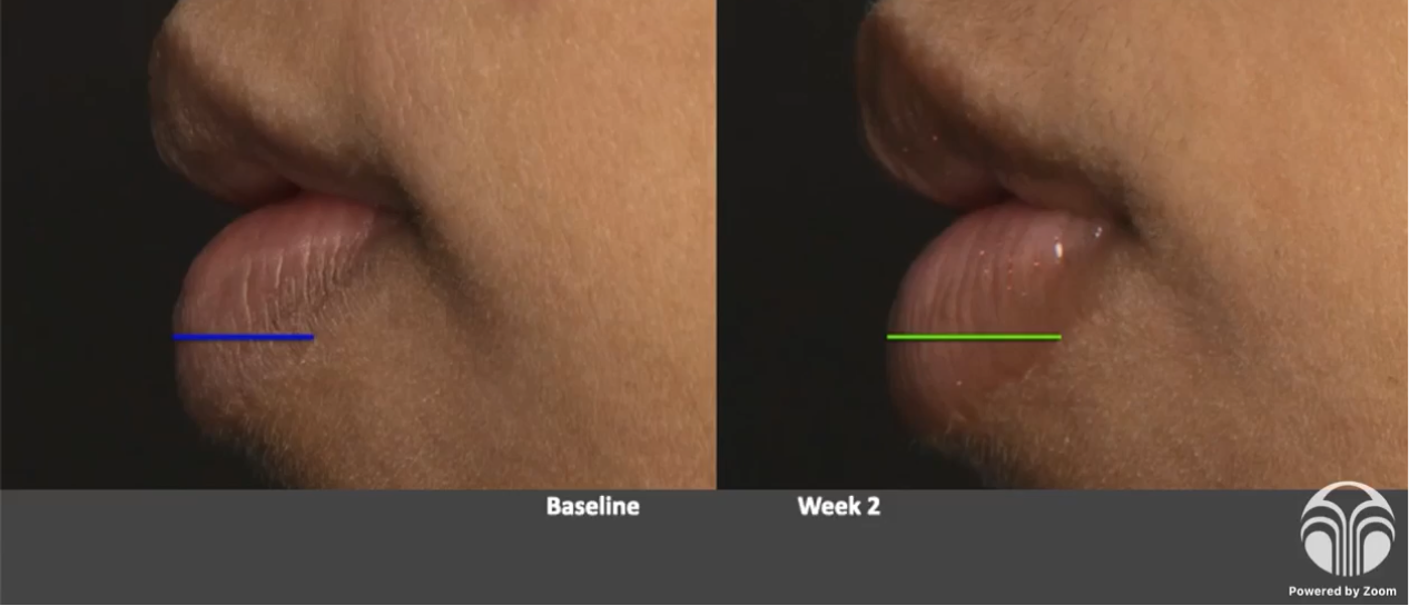 LIP PEPTIDE POUT