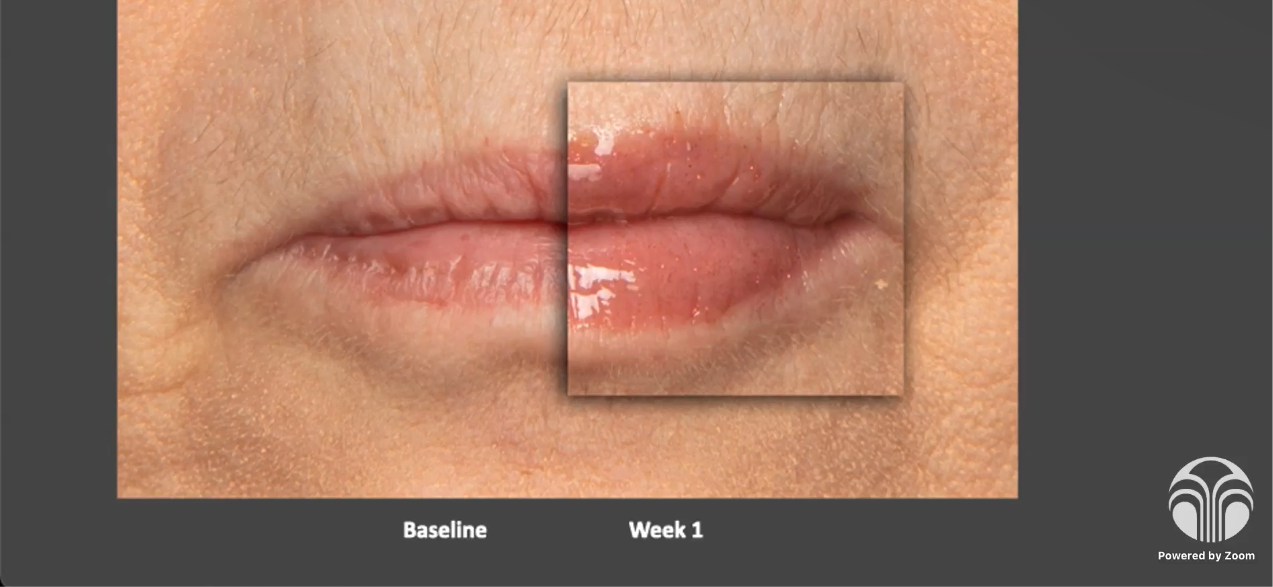 LIP PEPTIDE POUT