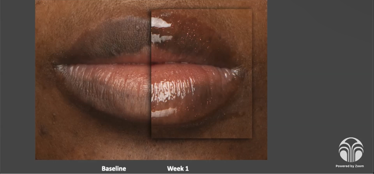 LIP PEPTIDE POUT