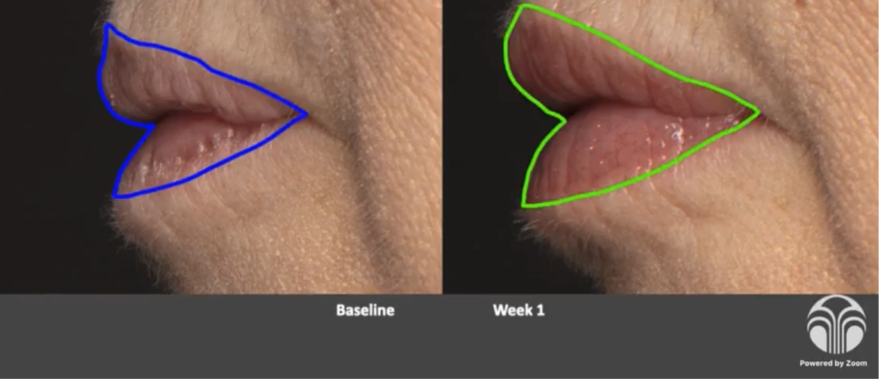 LIP PEPTIDE POUT